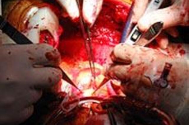 Širdies operacijos - naudojant naujos kartos dirbtinės kraujo apytakos sistemą