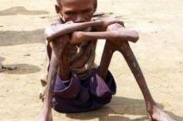 Pasaulyje badauja milijardas žmonių