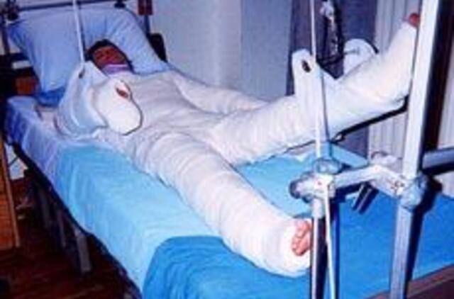 Lūžius skubiai gydys „įšvirkščiamas kaulas“