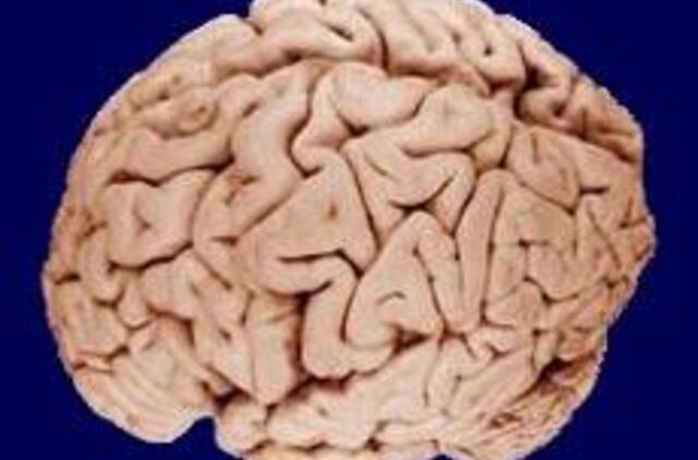 Insulto pažeistas smegenis "atstatinės“ kamieninės ląstelės