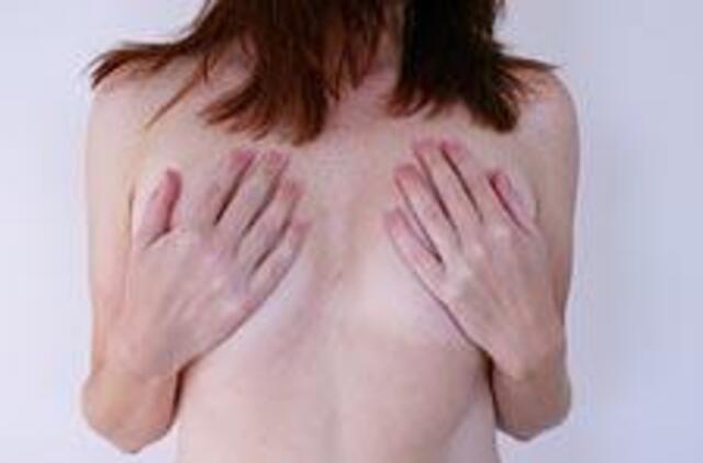 Genetiniai tyrimai gali padėti išvengti užprogramuoto krūties ir kiaušidžių vėžio