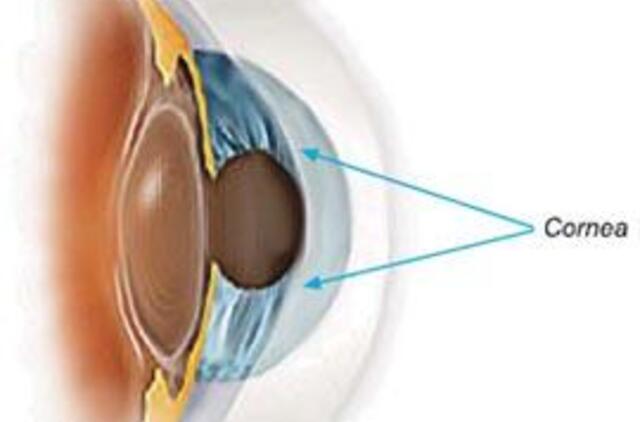 Atlikta pirmoji Lietuvoje ragenos protezavimo operacija
