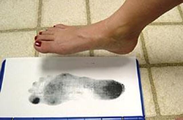 Plokščiapėdžiams - nauja gydymo metodika