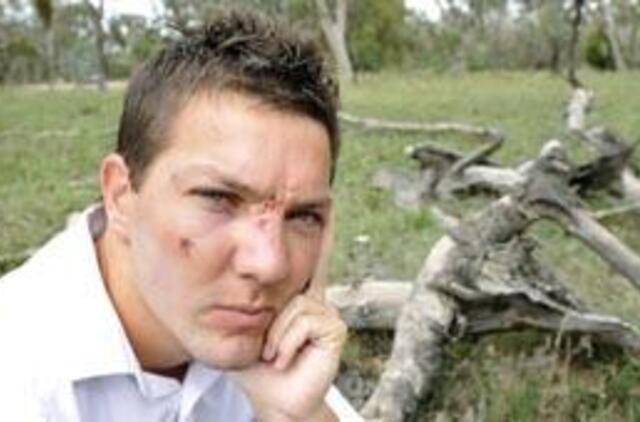 Kanberoje kengūra užpuolė žmogų