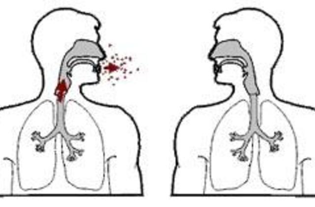 Mokslininkai: dėl recesijos Baltijos šalyse gali padaugėti tuberkuliozės atvejų