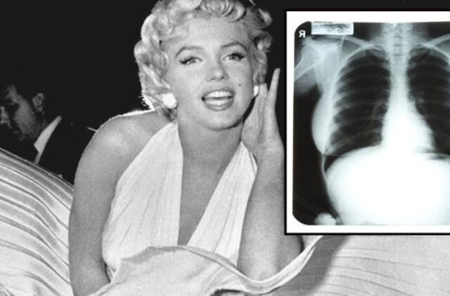 Marilyn Monroe rentgeno nuotraukos parduotos už 45 tūkst. dolerių