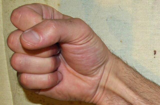 Klaipėdos senamiestyje sumušti estai