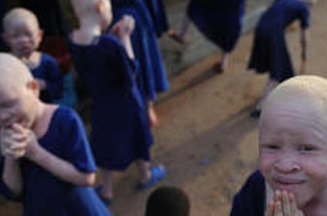 Burundyje ritualinės žmogžudystės auka vėl tapo albinosas berniukas