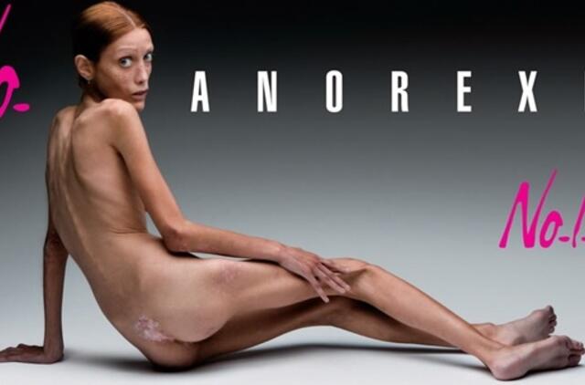 Mirė fotomodelis Isabelle Karo, išgarsėjusi šokiruojančia reklama prieš anoreksiją