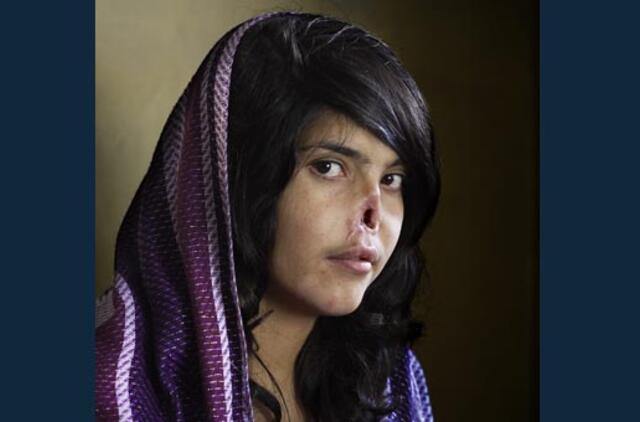 Metų nuotrauka tapo fotografija, vaizduojanti suluošintą afganę