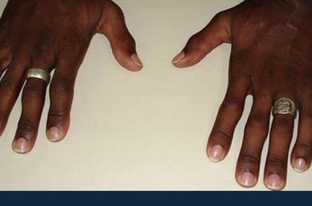 Prekeivį narkotikais išdavė 12 rankos pirštų