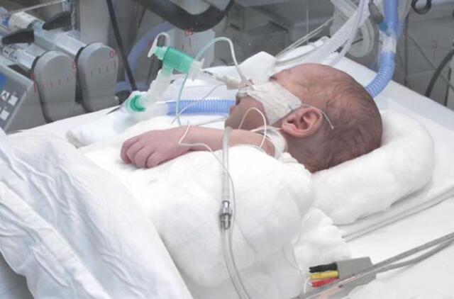 Kaune tėvas sumušė metukų mažylę