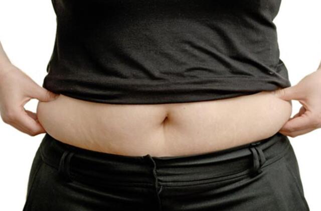 Pasaulyje daugiau žmonių turi antsvorį nei badauja