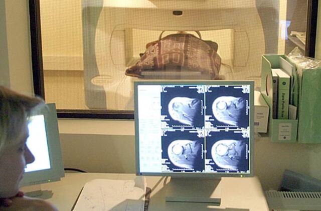 Informacija apie magnetinio rezonanso tomografijos tyrimą