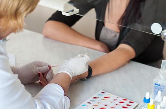 Mokslininkai nustatė, kaip organizmas kovoja su ŽIV