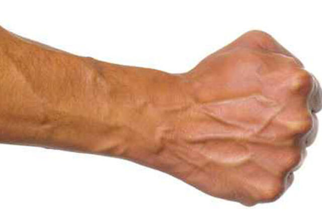 Nepažįstamasis smogė moteriškei ir išėjo