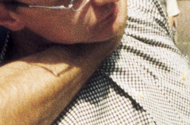 Nepažįstamasis smaugė ir peiliu perpjovė kaklą