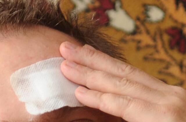 Smogė per galvą ir pagrobė piniginę su 2000 Lt