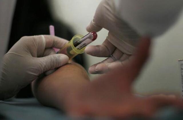 ŽIV prevencija turi rūpėti ne tik medikams