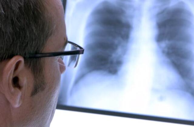 Ar prasidės Lietuvoje priverstinio tuberkuliozės gydymo era?