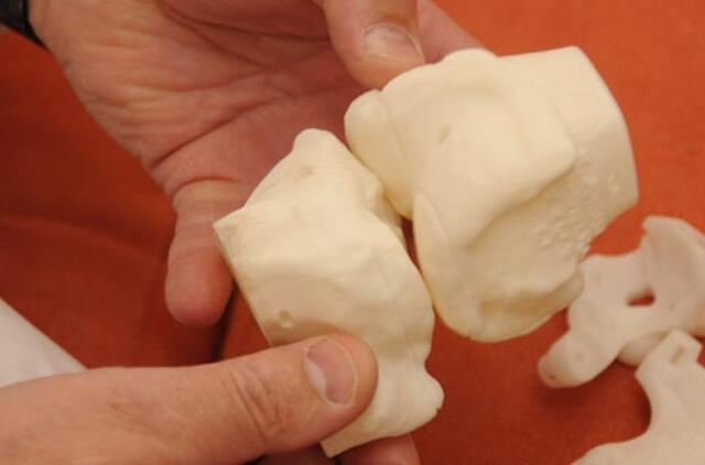 Laukiantiems kelio ar klubo sąnario keitimo operacijų - geros žinios