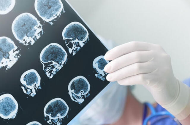 Klaipėdoje kviečiami burtis sergantieji epilepsija