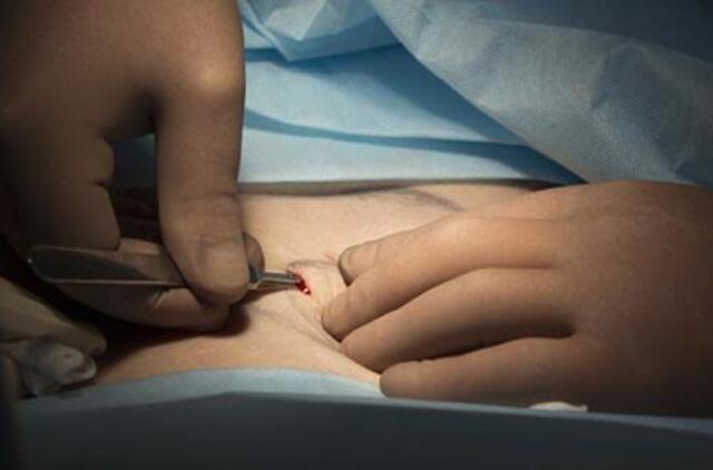 Moters lytinių organų apipjaustymą siūloma laikyti nusikaltimu