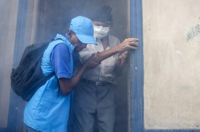 Zikos virusas nustatytas seilėse ir šlapime