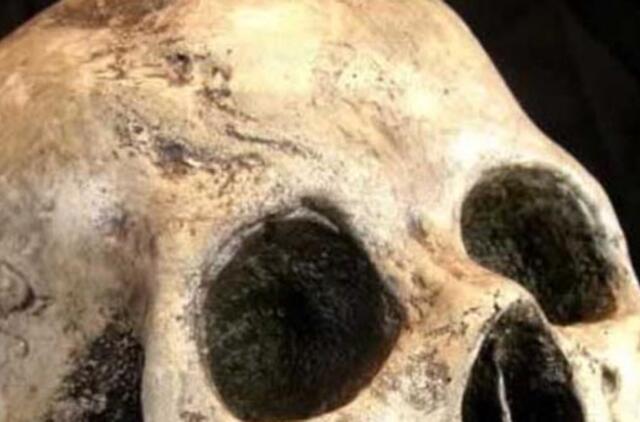 Savanorių gatvės miškelyje ant kelmo rasta žmogaus kaukolė