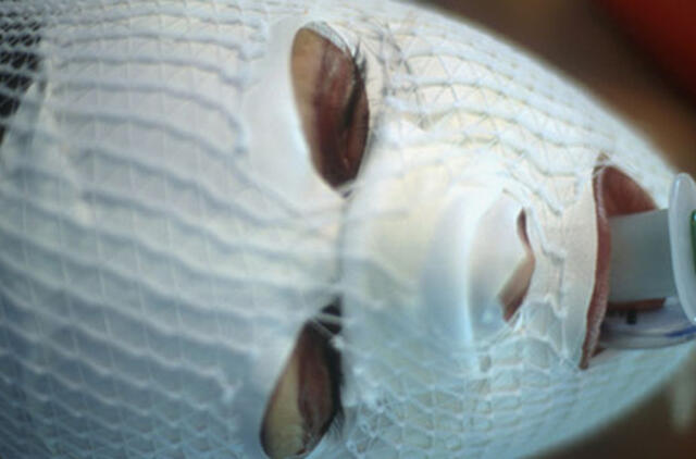 Nutrauktas tyrimas dėl vyro pūvančiu veidu