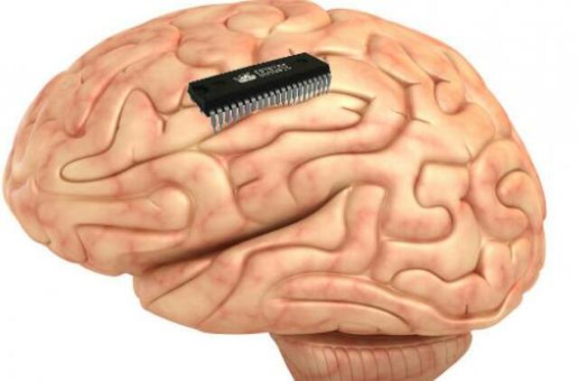 Mokslininkai išrado ir sėkmingai išbandė atminties „protezą“