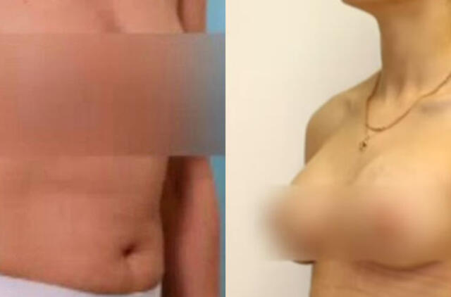 Išaiškinti trys vyrai, pasisavinę klinikos „Grožio chirurgija“ duomenis