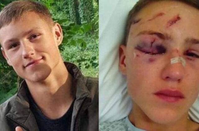 Darbas statybose Mindaugui baigėsi tragiškai: liko be akies