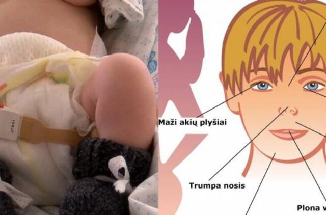 Girti gimę kūdikiai: kaip vėliau klostėsi likimai