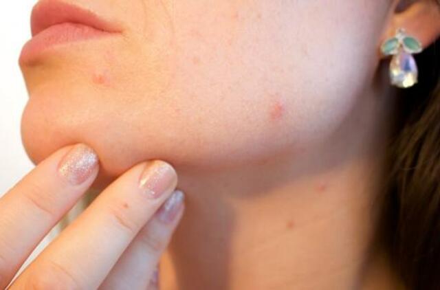 Ką daryti, kad kosmetikos naudojimas nesukeltų odos problemų?