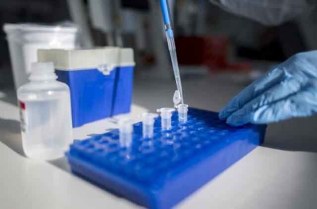 Klaipėdos universitetinės ligoninės laboratorija dėl sugedusios įrangos neatliko tyrimų