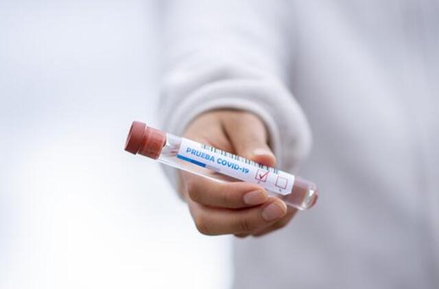 Mokamus koronaviruso testus galima atlikti 5 laboratorijose