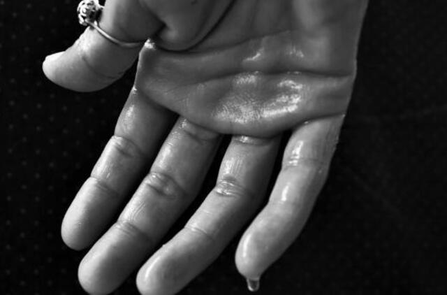 Nemalonus pėdų ir rankų prakaitavimas – signalas įspėjantis apie rimtas ligas