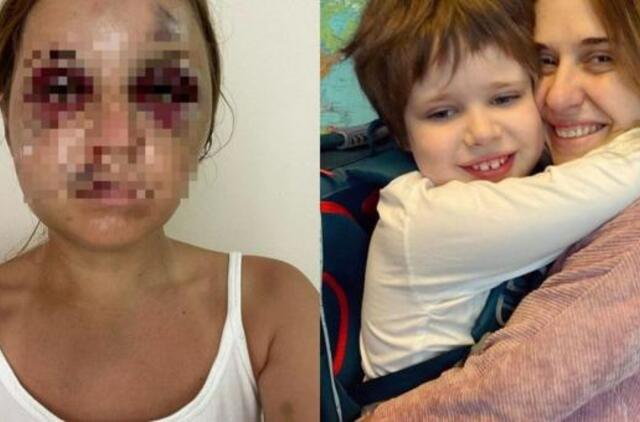 Žiauriai sumušta ir išprievartauta su 6-erių sūnumi traukiniu keliavusi Ukrainos žvaigždė