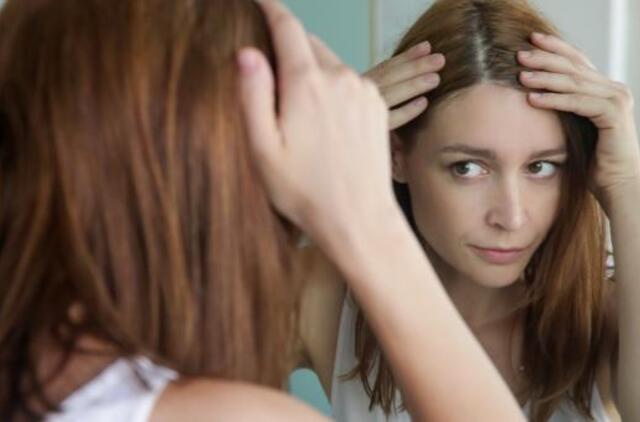 Pleiskanos - kada vertėtų sunerimti?