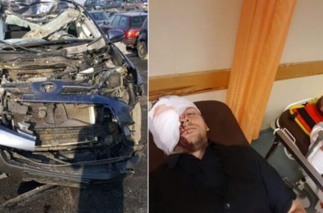 „X faktorius. Žvaigždės“ dalyviai „Twosome“ pateko į avariją: sužalotas veidas ir sutrupėjęs kaklo slankstelis