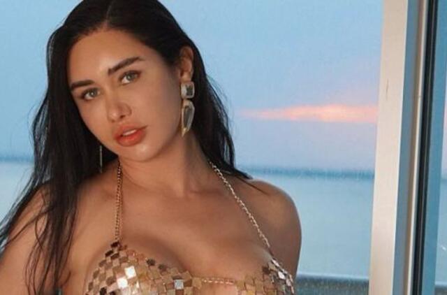 Garsus Meksikos modelis mirė po nesėkmingos grožio operacijos: norėjo turėti sėdmenis kaip K. Kardashian