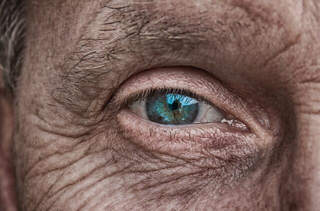Akyje esantis stiklakūnio skystis gali padėti nustatyti Alzheimerio ligą.