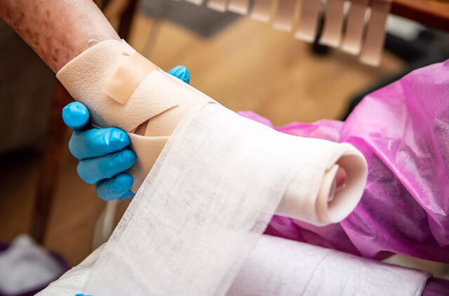 Naujas genų terapijos gelis - pirmasis patvirtintas retos ir skausmingos "drugelių ligos" gydymo būdas 