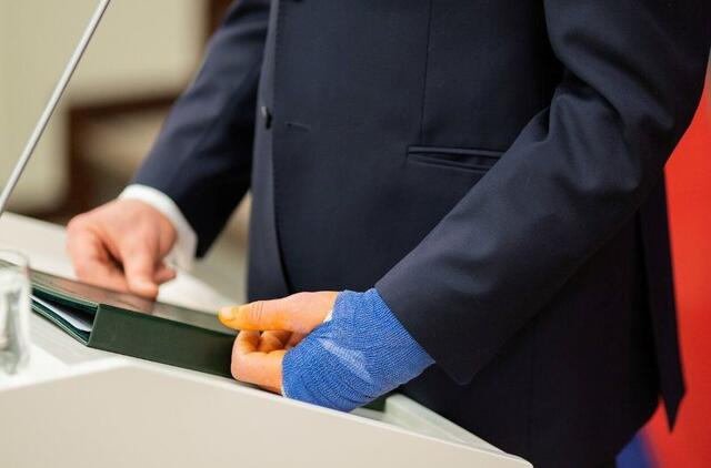 Prezidentas Gitanas Nausėda susižeidė ranką